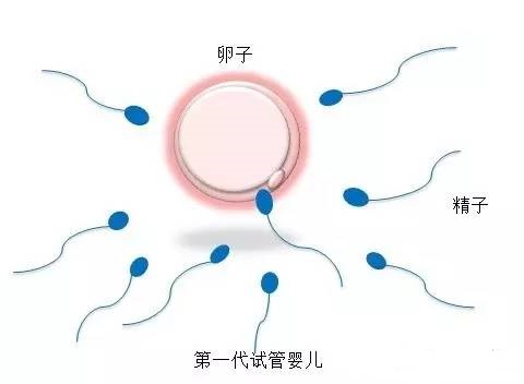 胚胎操作
